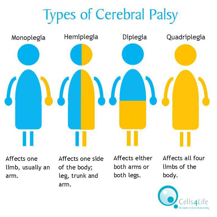 Types_of_Cerebral_Palsy