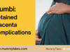How complications from a retained placenta claimed Mumbi’s life: documenting maternal deaths in Kenya maternal-death-stories-in-Kenya