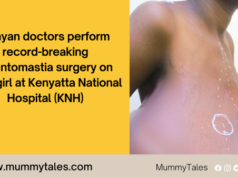 Kenyan doctors perform record-breaking gigantomastia surgery at Kenyatta National Hospital gigantomastia surgery Kenya