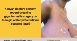 Kenyan doctors perform record-breaking gigantomastia surgery at Kenyatta National Hospital gigantomastia surgery Kenya