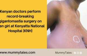Kenyan doctors perform record-breaking gigantomastia surgery at Kenyatta National Hospital gigantomastia surgery Kenya