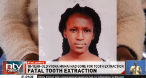 Is a tooth extraction during pregnancy safe?